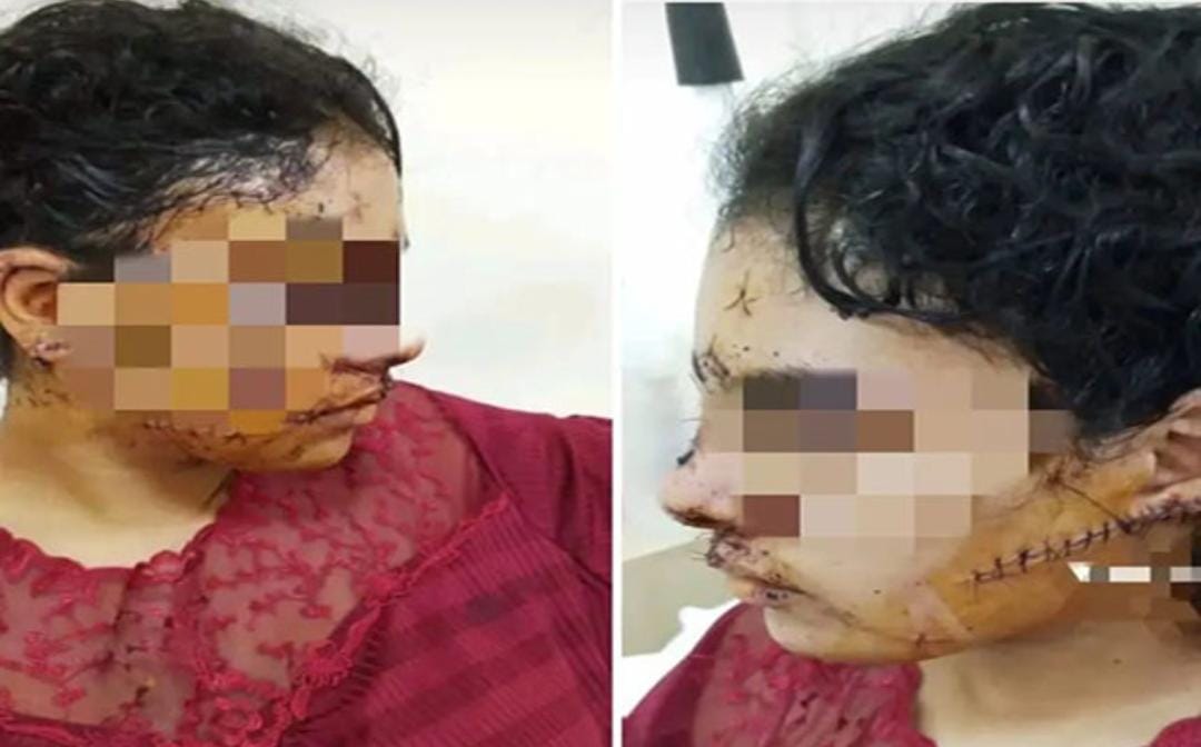 حادث تازة يعيد إلى الواجهة نقاش فعالية قانون مناهضة العنف ضد النساء